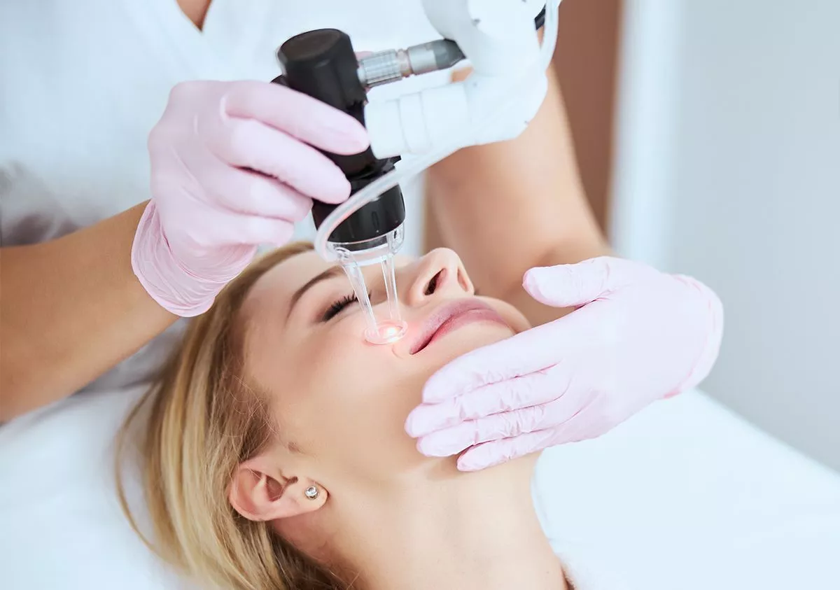 Fraksiyonel Lazer Yaptıranlar Fraksiyonel Lazer Yaptıranlar